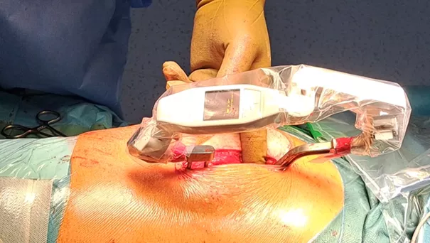 Urządzenie pomiarowe w polu operacyjnym